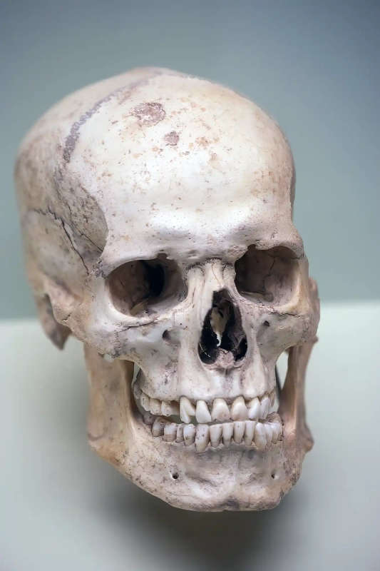Teruel skull